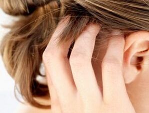 Anzeichen und Symptome von Psoriasis auf der Kopfhaut
