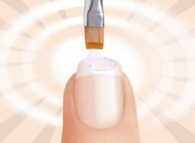 Behandlung von Nagelpsoriasis